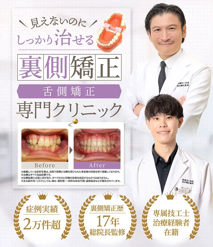 見えないのにしっかり治せる裏側矯正