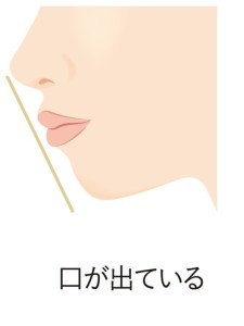 口ゴボのイラスト