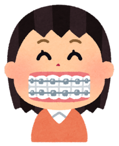 歯列矯正している女性のイラスト