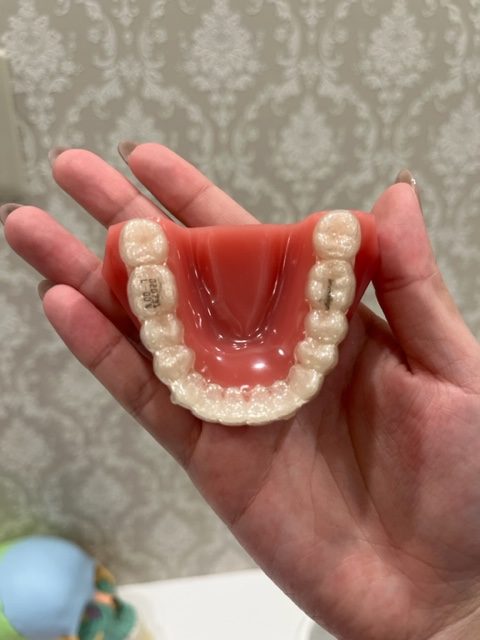 歯肉退縮のセルフケア、嚙み締め癖があるならマウスピース装着 歯茎が下がらないためにできること