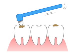 タフトブラシ　デンタルケア　矯正