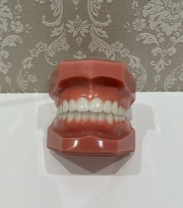 歯並び　部分矯正