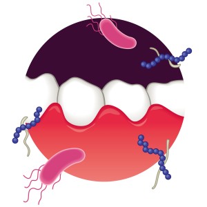 歯周病　歯ぎしり　虫歯　 出っ歯の原因