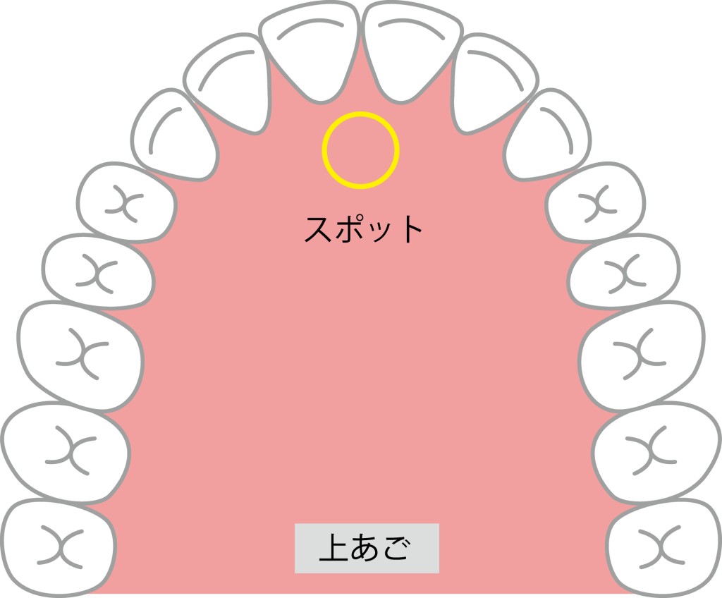 MFT　舌　滑舌　スポットポジション　歯並び