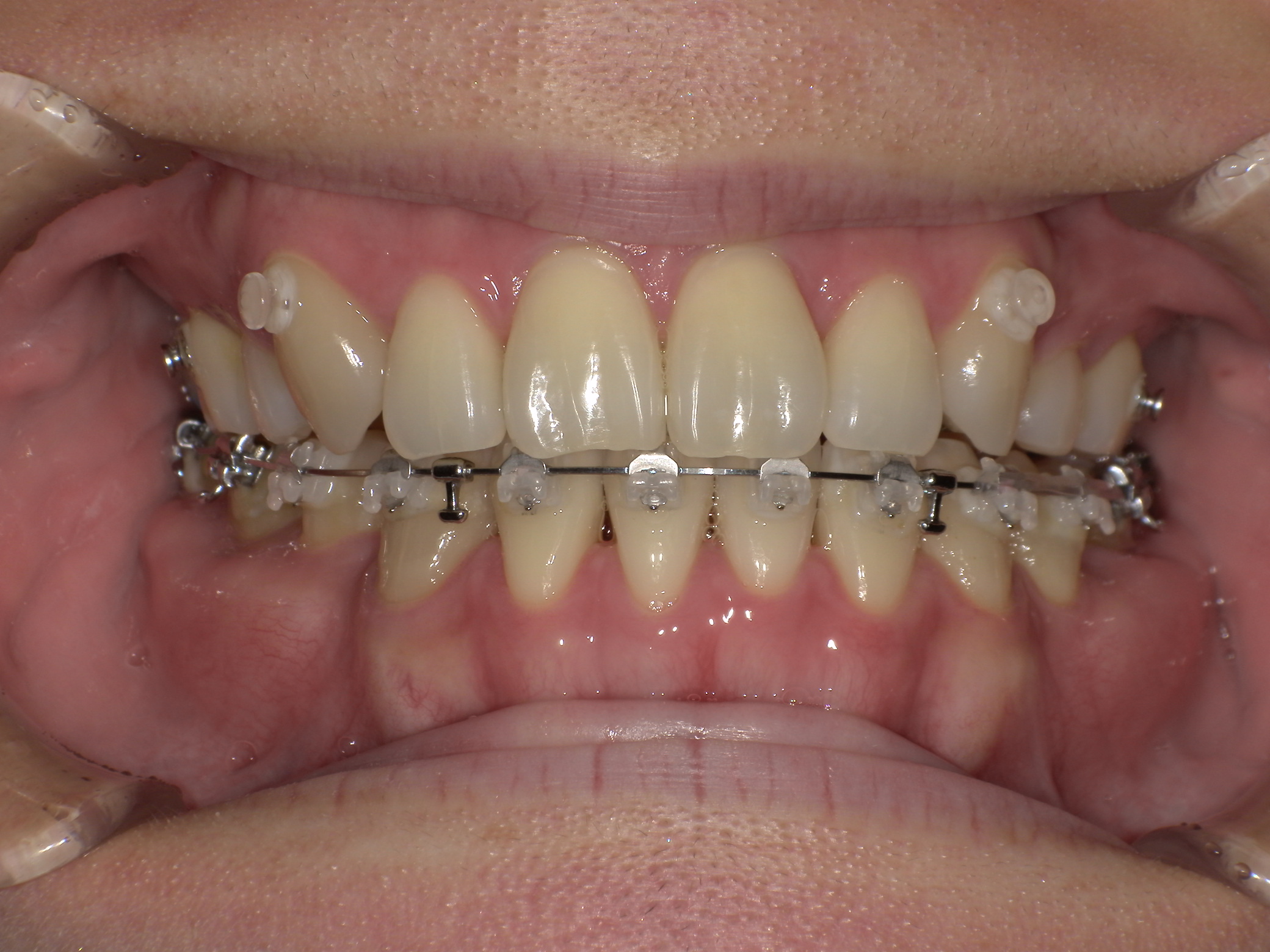 case47_socket After