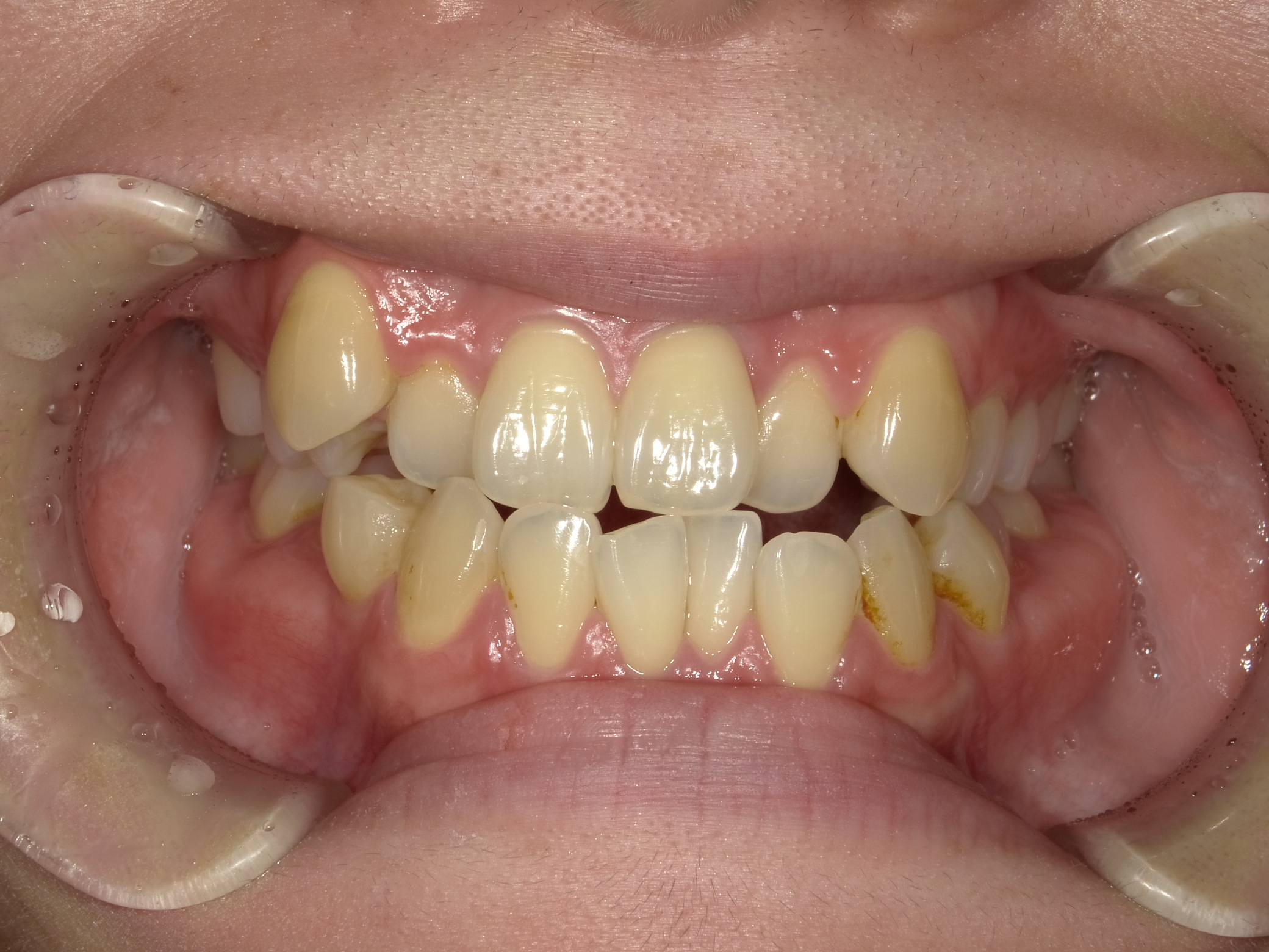 case47_socket Before