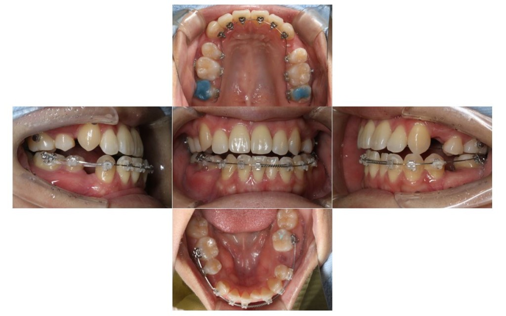 case47_socket2