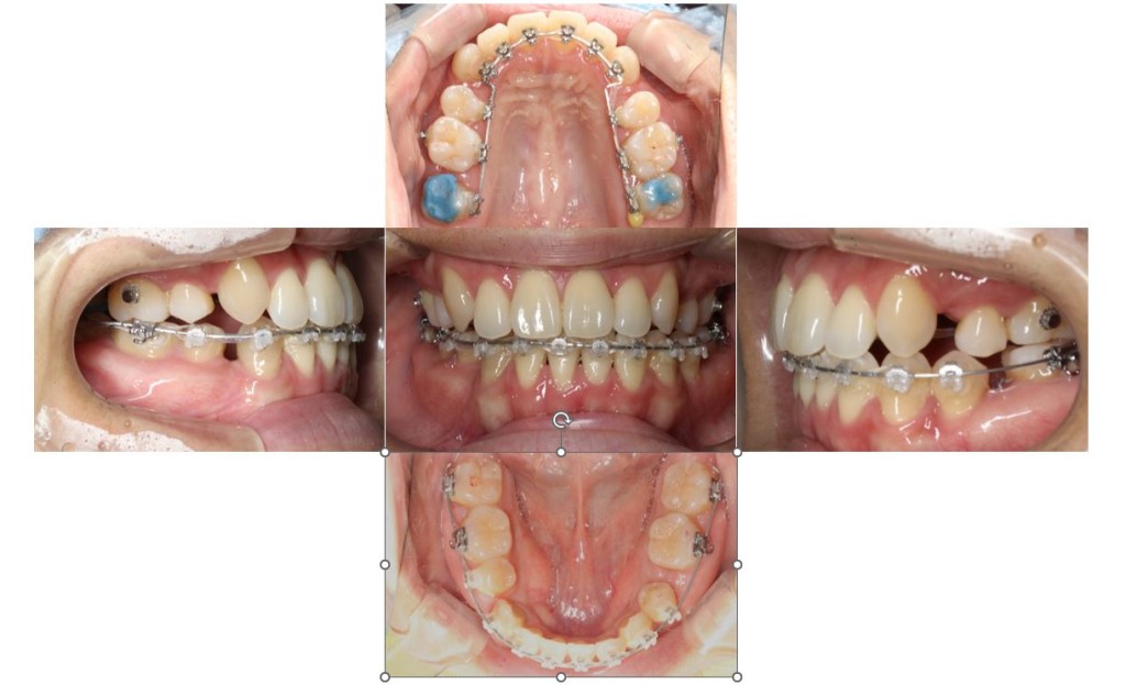 case47_socket3