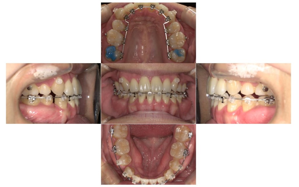 case47_socket5