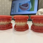 歯列矯正カウンセリング 矯正装置をつけるまで 矯正開始までの期間