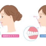 口ゴボかどうかセルフチェック　綺麗なEラインと口ゴボのEラインの違い　口ゴボの歯列矯正の効果