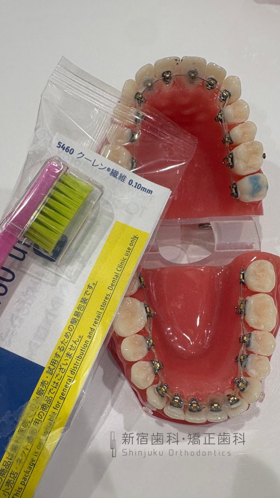 歯がしみる場合の対処法について　歯がしみる場合のセルフケアについて