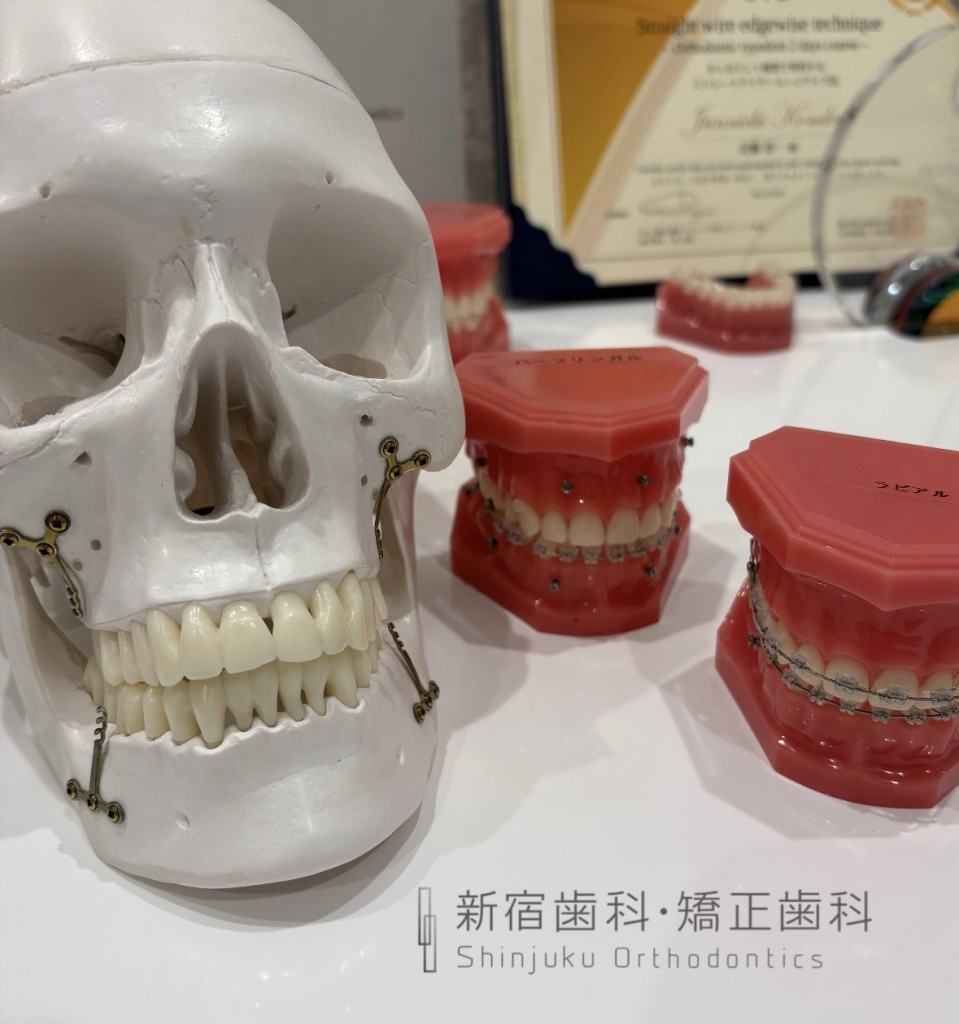 矯正治療中に 健康的に過ごすための工夫について　歯列矯正中に変に痩せない為のポイント