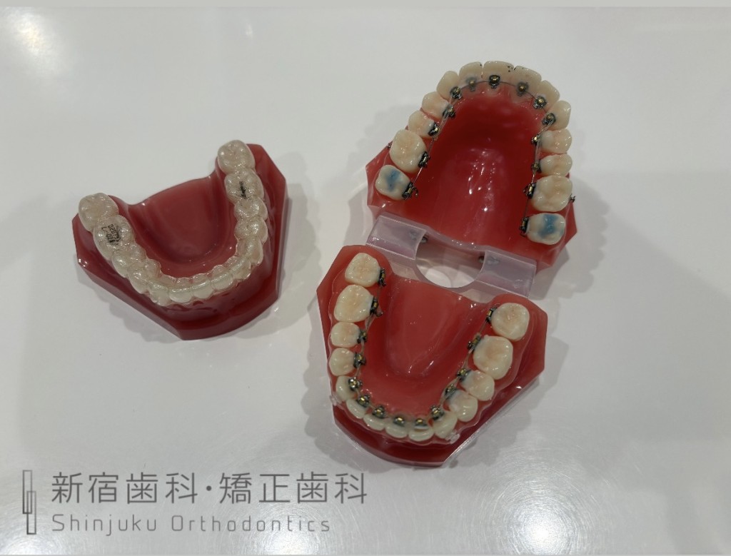 仕事と両立できる矯正装置の種類・特徴? 目立たない矯正方法だと周りから気付かれない?