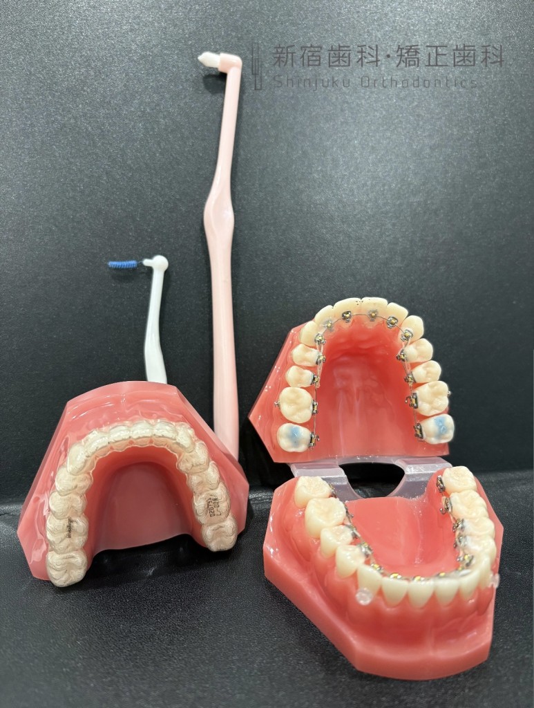 食事制限・通院回数・ケアを減らすために気をつけたいこと　矯正中の出先や旅行中のケア方法とは