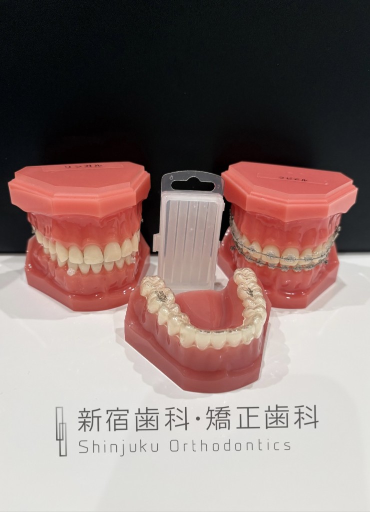 ライフステージによって生活・通院・予算・矯正装置選びが異なる理由とは 矯正開始タイミングとライフステージについて