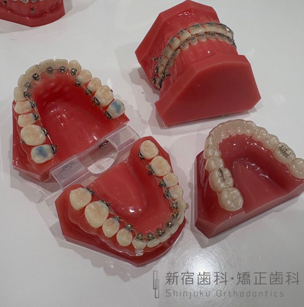 運動・演奏趣味に合わせた矯正装置の種類とは ご自身の趣味に合わせた矯正方法とは