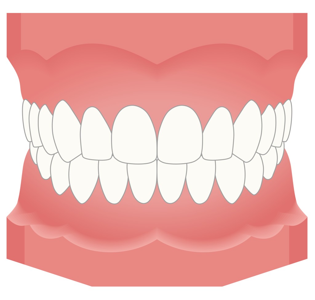 口元の健康とは何か？ 歯並び・噛み合わせが全身に及ぼす影響はなにか