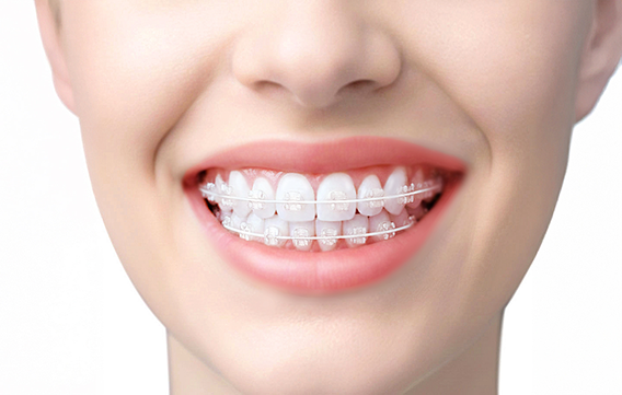 ホワイトワイヤー